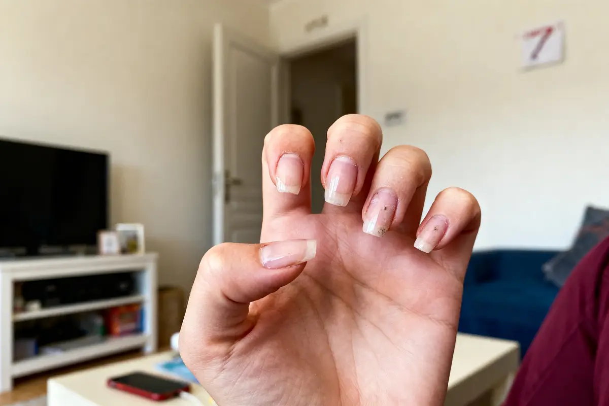 Main montrant des ongles longs et inégaux dans un salon avec télévision en arrière-plan.